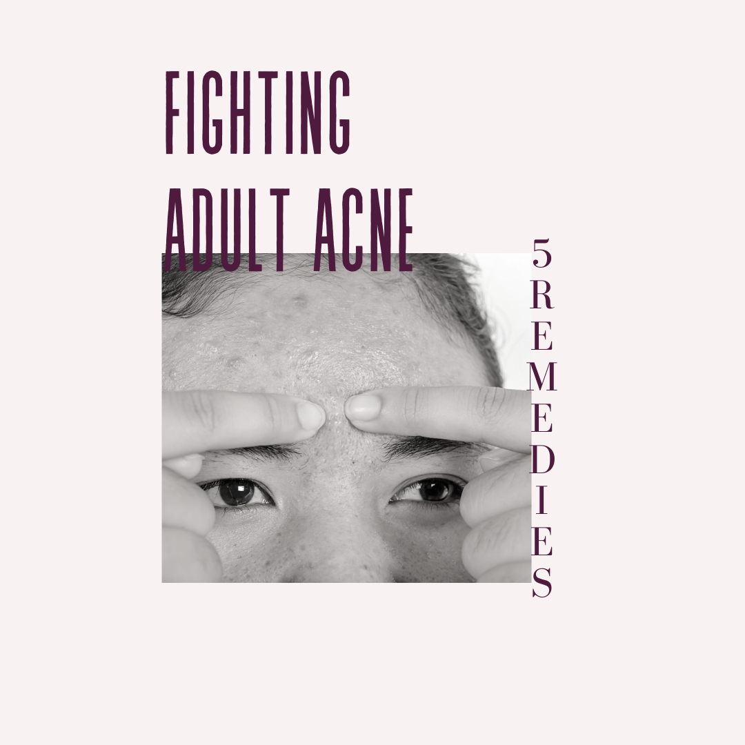 Thumbnail cover The FREE download pdf 5 Remedies for Fighting Adult Acne by LaDonna Takyi Taylor
